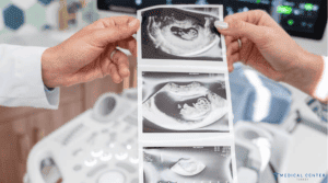 Healthy Babies: Embryo Transfer in Turkey