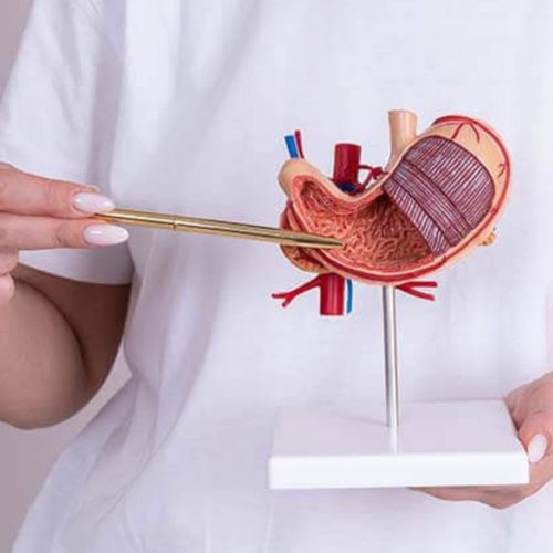 Frequently Asked Questions About Gastric Bypass Surgery Frequently Asked Questions About Gastric Bypass Surgery