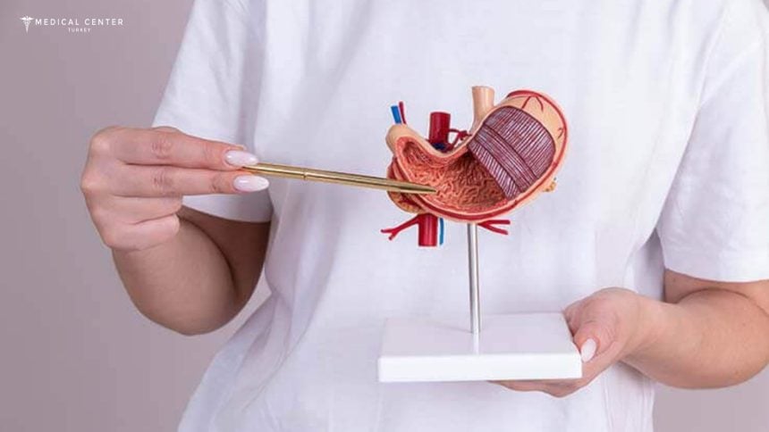 Frequently Asked Questions About Gastric Bypass Surgery