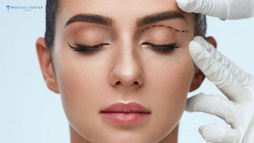 Eyelid Surgery (Blepharoplasty) Techniques in Turkey