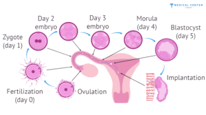 Healthy Babies: Embryo Transfer in Turkey