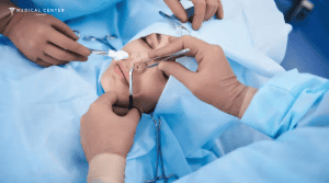 What You Need to Know Before Getting a Nose Surgery