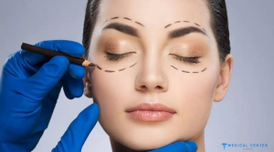 Fox Eyes Surgery in Turkey 