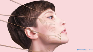 Fox Eyes Surgery in Turkey 4