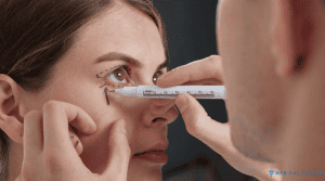 Fox Eyes Surgery in Turkey 6