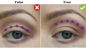 Hooded Eyes