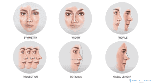 How to Choose the Right Rhinoplasty for your Face Shape