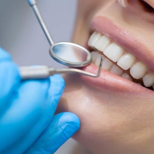 Why Do People Go to Turkey for Dental Treatment?