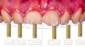 What is Restorative Dentistry?