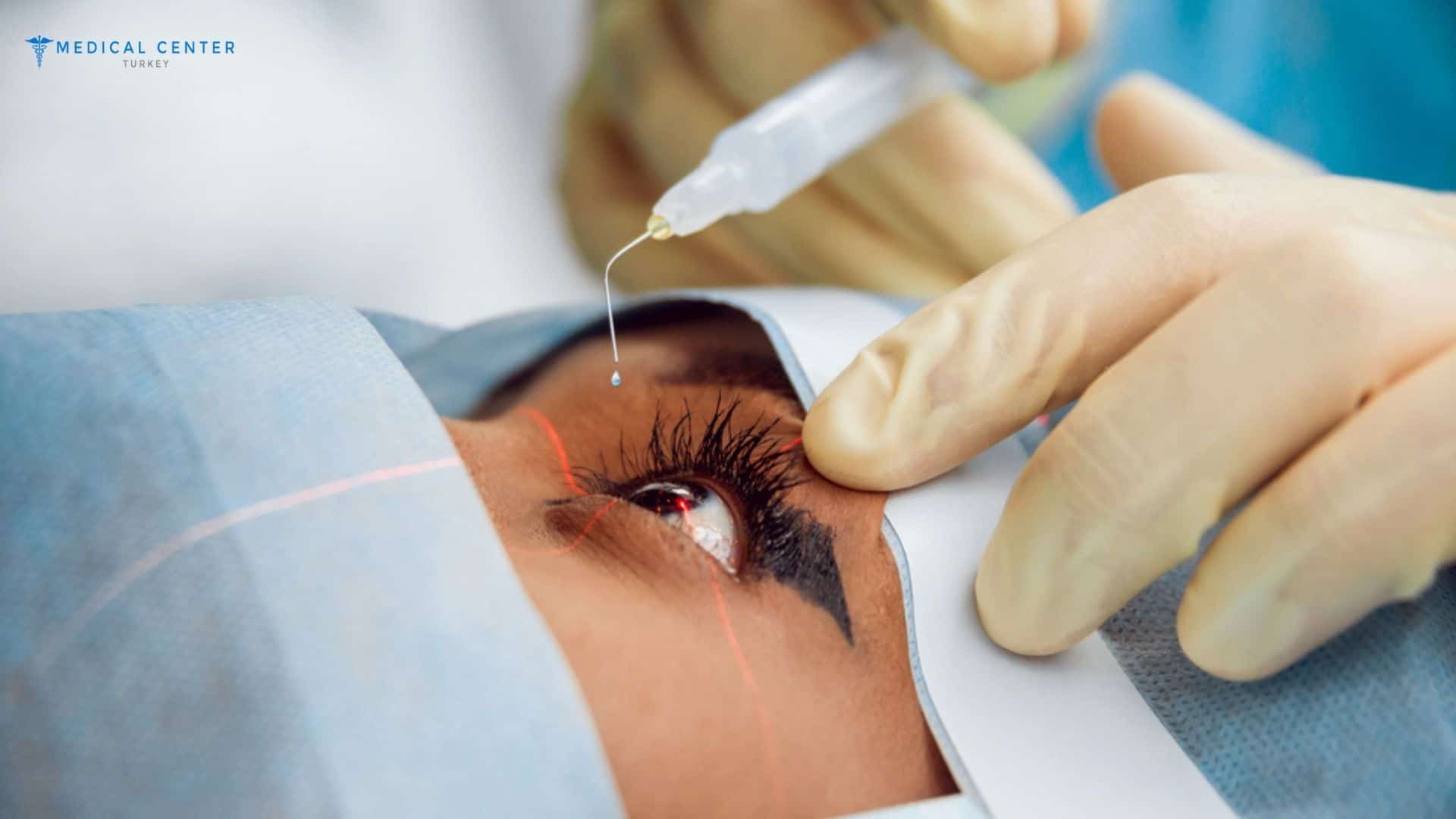 Types of Eye Operations in Turkey