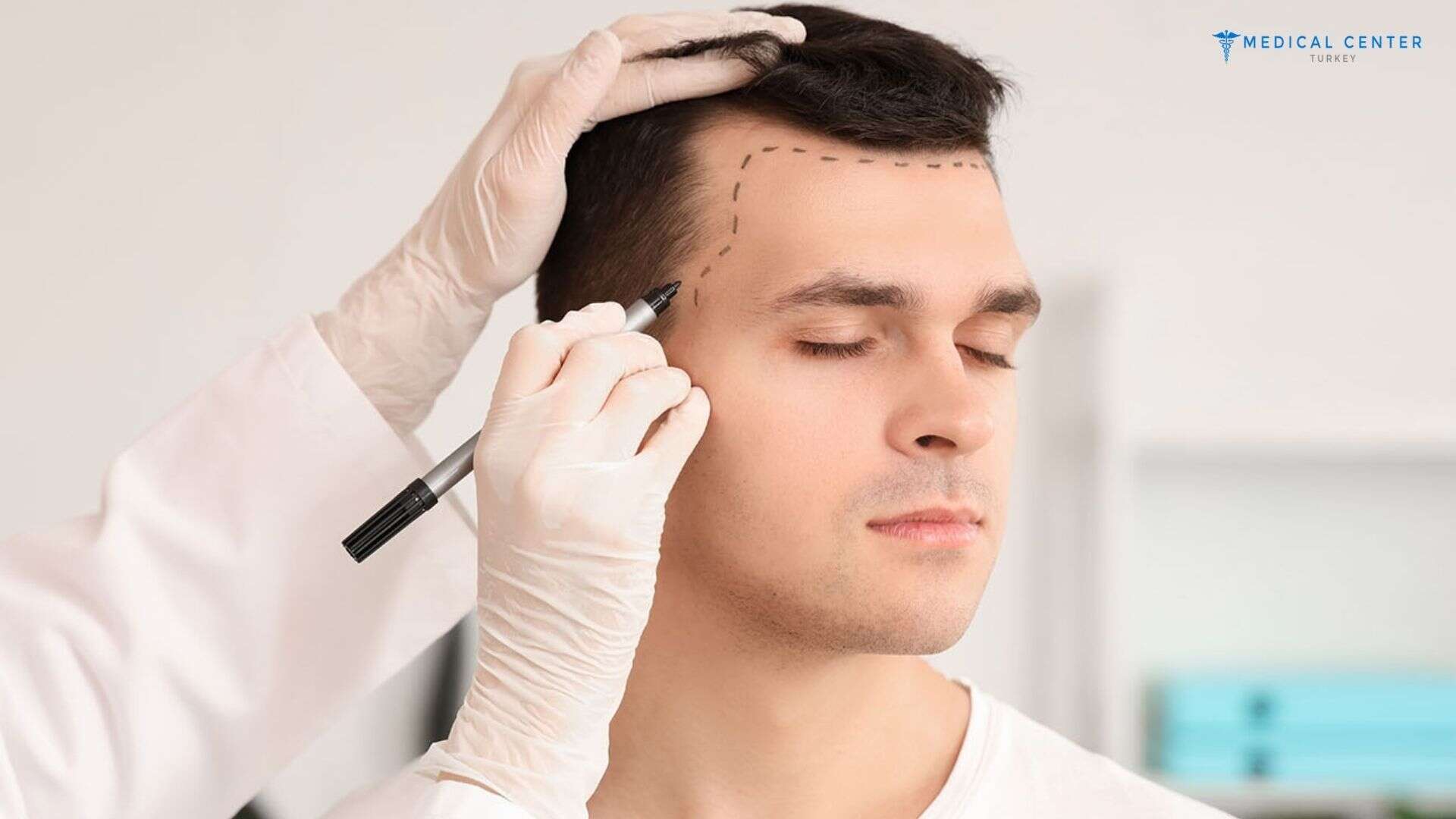 How Long Is the Hair Transplant Recovery Time?