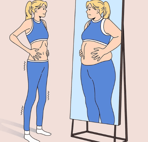 Body Dysmorphic Disorder and Cosmetic Surgery