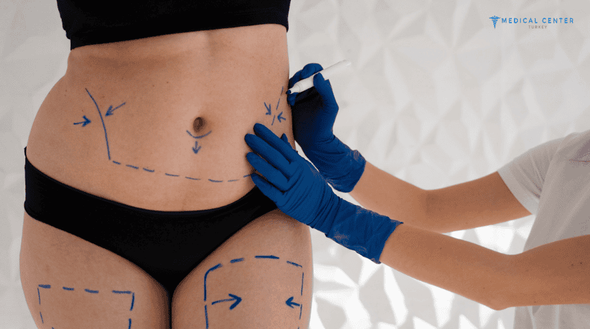 The Role of Fat Transfer in Modern Cosmetic Surgery