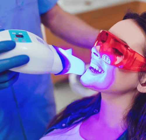 Effective Treatments for Tooth Discoloration in Turkey