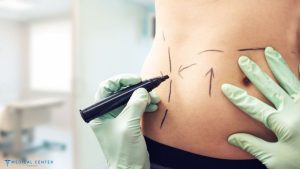 The Role of Fat Transfer in Modern Cosmetic Surgery