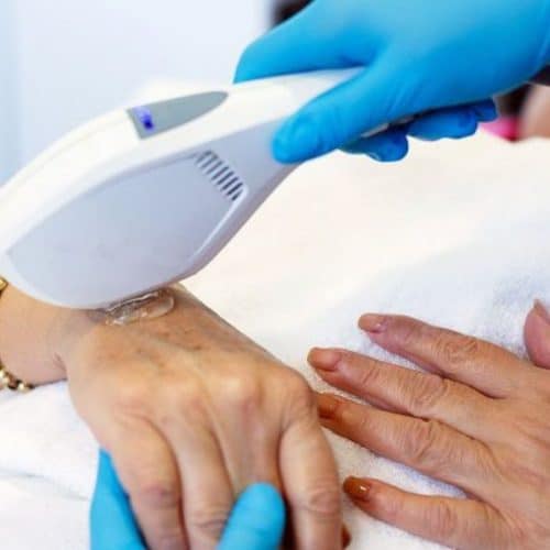 Rejuvenating Hand Treatments: Anti-Aging Solutions for Your Hands in Turkey Rejuvenating Hand Treatments: Anti-Aging Solutions for Your Hands in Turkey