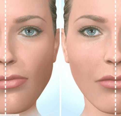 Achieving Symmetry: Asymmetry Correction Procedures in Turkey Achieving Symmetry: Asymmetry Correction Procedures in Turkey