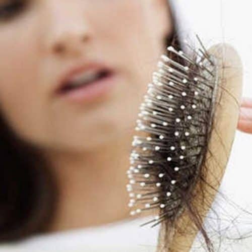 Female Hair Transplant All You Need To Know