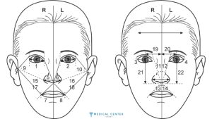 Achieving Symmetry Asymmetry Correction Procedures in Turkey 3