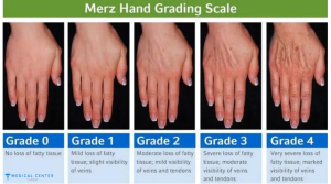 Rejuvenating Hand Treatments: Anti-Aging Solutions for Your Hands in Turkey