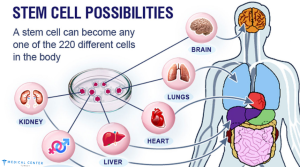 Stem Cell Therapy for Autism