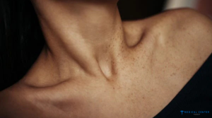 A 2025 Solution for a Youthful Neckline