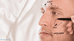 The Rise of Male Cosmetic Procedures: What's Popular in Turkey?
