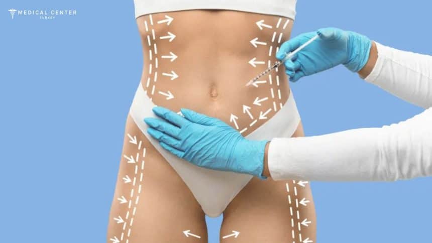 Laser Lipo vs. Vaser Lipo: Which is Better for 2025?