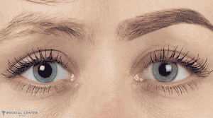 Eyebrow Transplant in Turkey Prices 2025