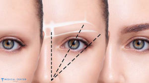 Eyebrow Transplant in Turkey Prices 2025