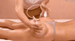 How a Butt Lift Can Boost Your Confidence in 2025