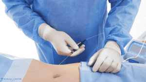 Laser Lipo vs. Vaser Lipo: Which is Better for 2025?