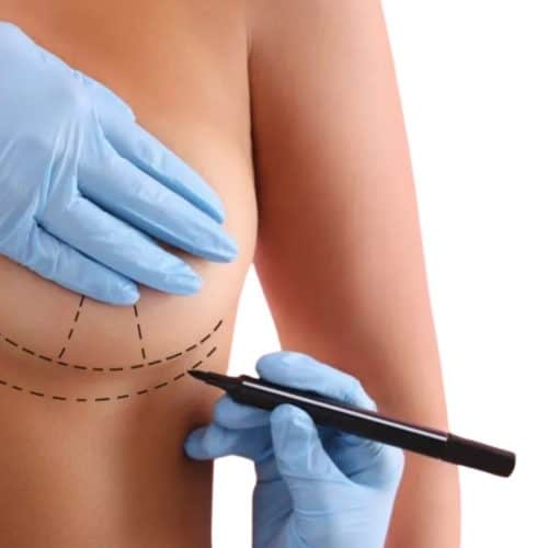 Is Breast Augmentation Still a Popular Choice for 2025? Is Breast Augmentation Still a Popular Choice for 2025?