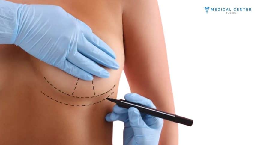 Is Breast Augmentation Still a Popular Choice for 2025?