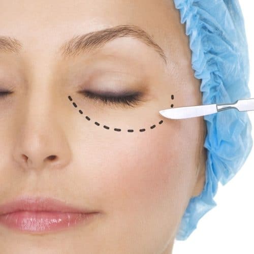 Eye Lift in 2025: Say Goodbye to Droopy Eyelids Eye Lift in 2025: Say Goodbye to Droopy Eyelids