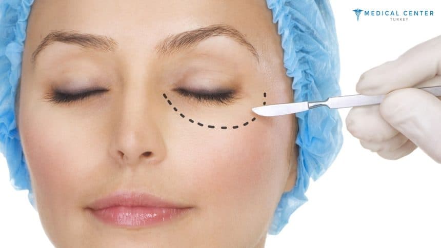 Eye Lift in 2025: Say Goodbye to Droopy Eyelids