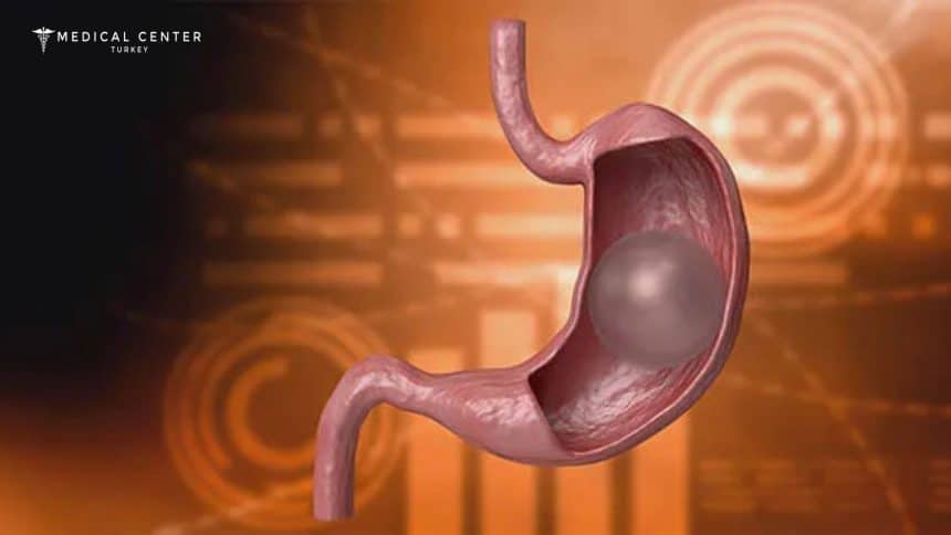 Gastric Balloon in Istanbul 2025: Time to Heal