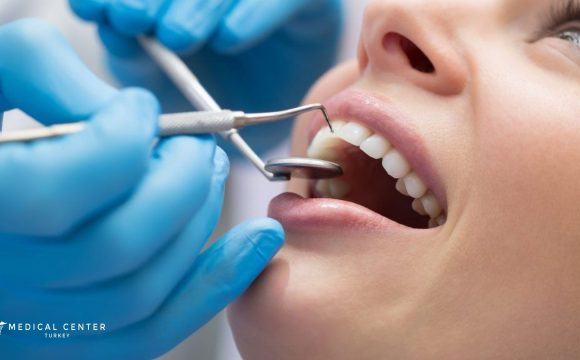10 Best Countries for Dental Implants