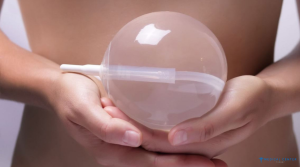 Gastric Balloon in Istanbul 2025: Time to Heal