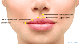 How Much is a Lip Lift in Turkey 2025 5