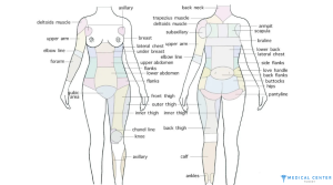 Is a Full Body Liposuction Worth It in Turkey?