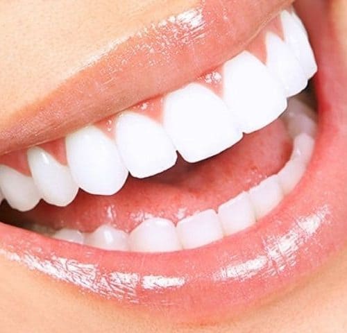 What You Need to Know About Dental Veneers in Turkey 2025