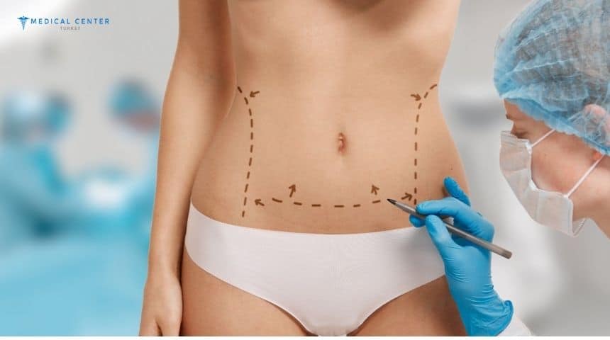 What Are the Risks Involved in Liposuction? What Are the Risks Involved in Liposuction?