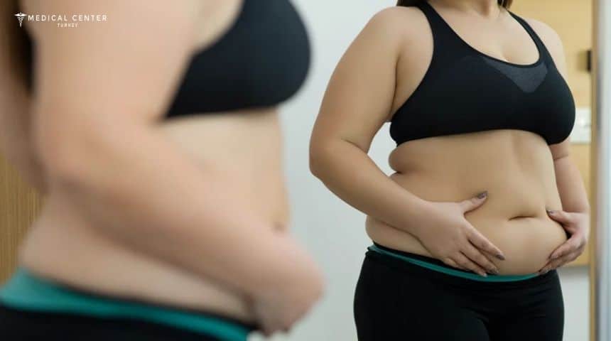 Is a Full Body Liposuction Worth It in Turkey?