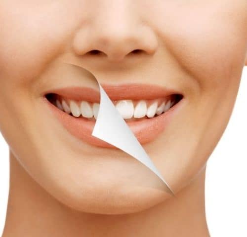 What to Know Before Getting a Dental Makeover in Turkey 2025