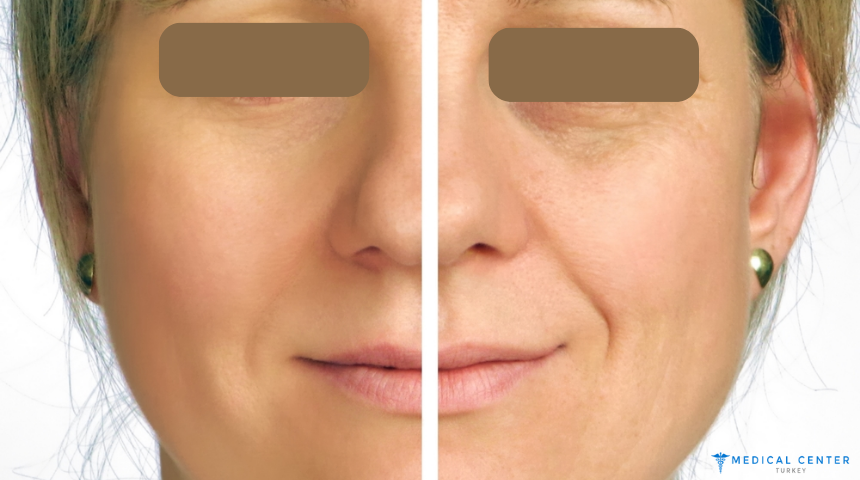 What’s New in 2025 for Facial Rejuvenation