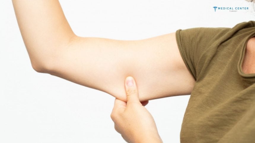 Why 2025 is the Best Time to Get a Mini Arm Lift?