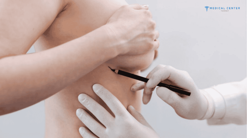 How Much Does a Complete Breast Augmentation Package Cost in 2025?