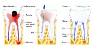 Is Dental Treatment in Turkey Reliable in 2025 ?