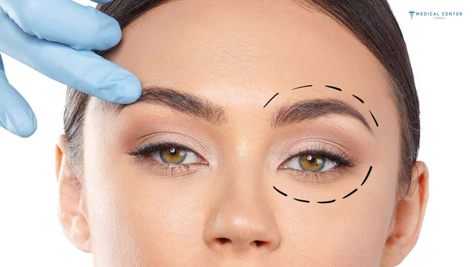 What Eye Surgeries Are Offered in Turkey in 2026?